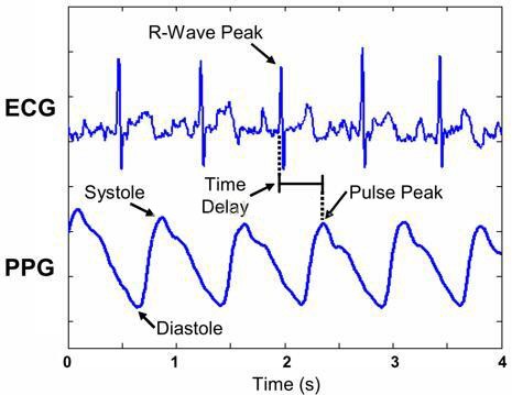 Comparison of PPG signal and ECG signal Comparison of PPG signal and ECG signal